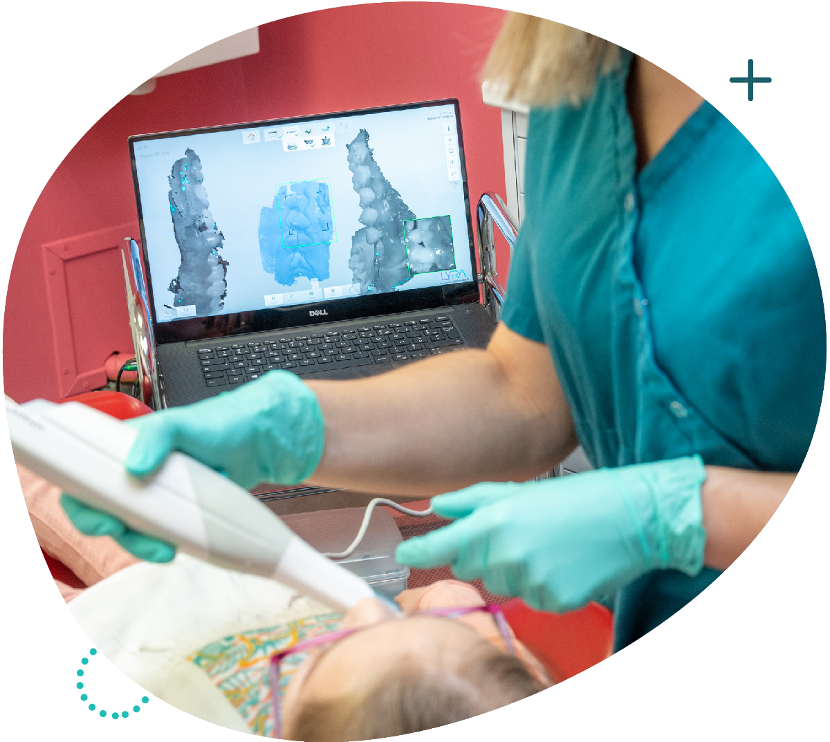 Empreinte numérique - Docteur Petitprez - Orthodontiste à Estaires.