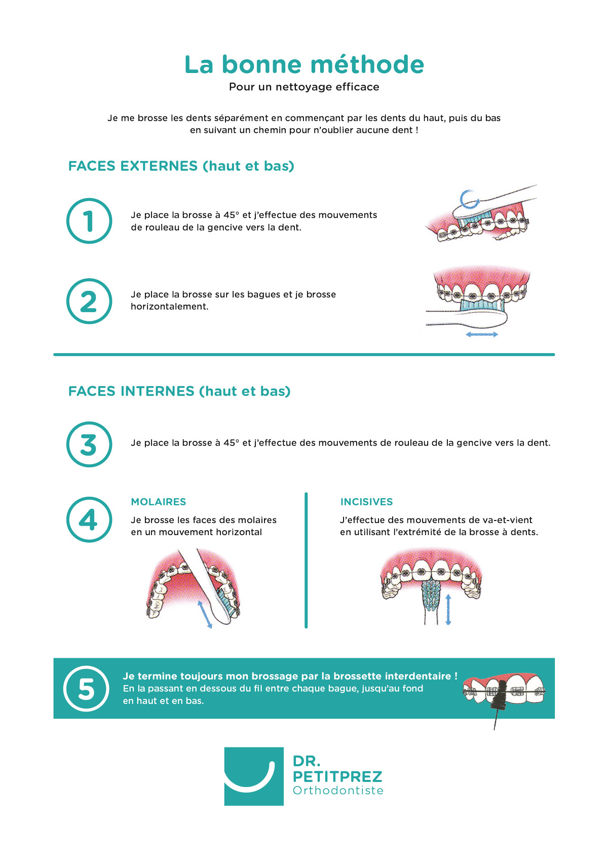 La bonne méthode pour se brosser les dents - Docteur Petitprez - Orthodontiste à Estaires.