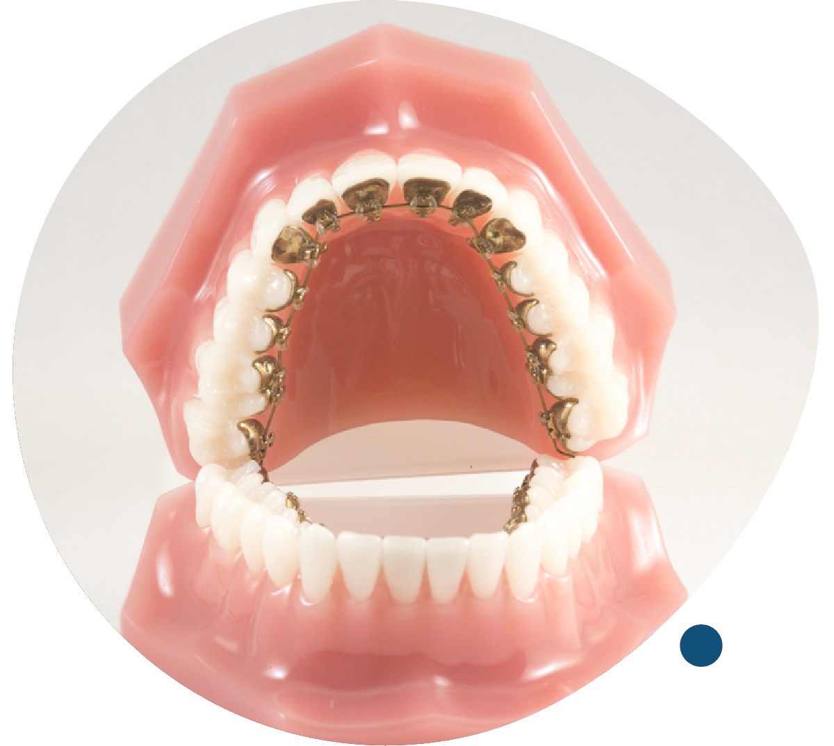 Orthodontie Linguale - Docteur Petitprez - Orthodontiste à Estaires.